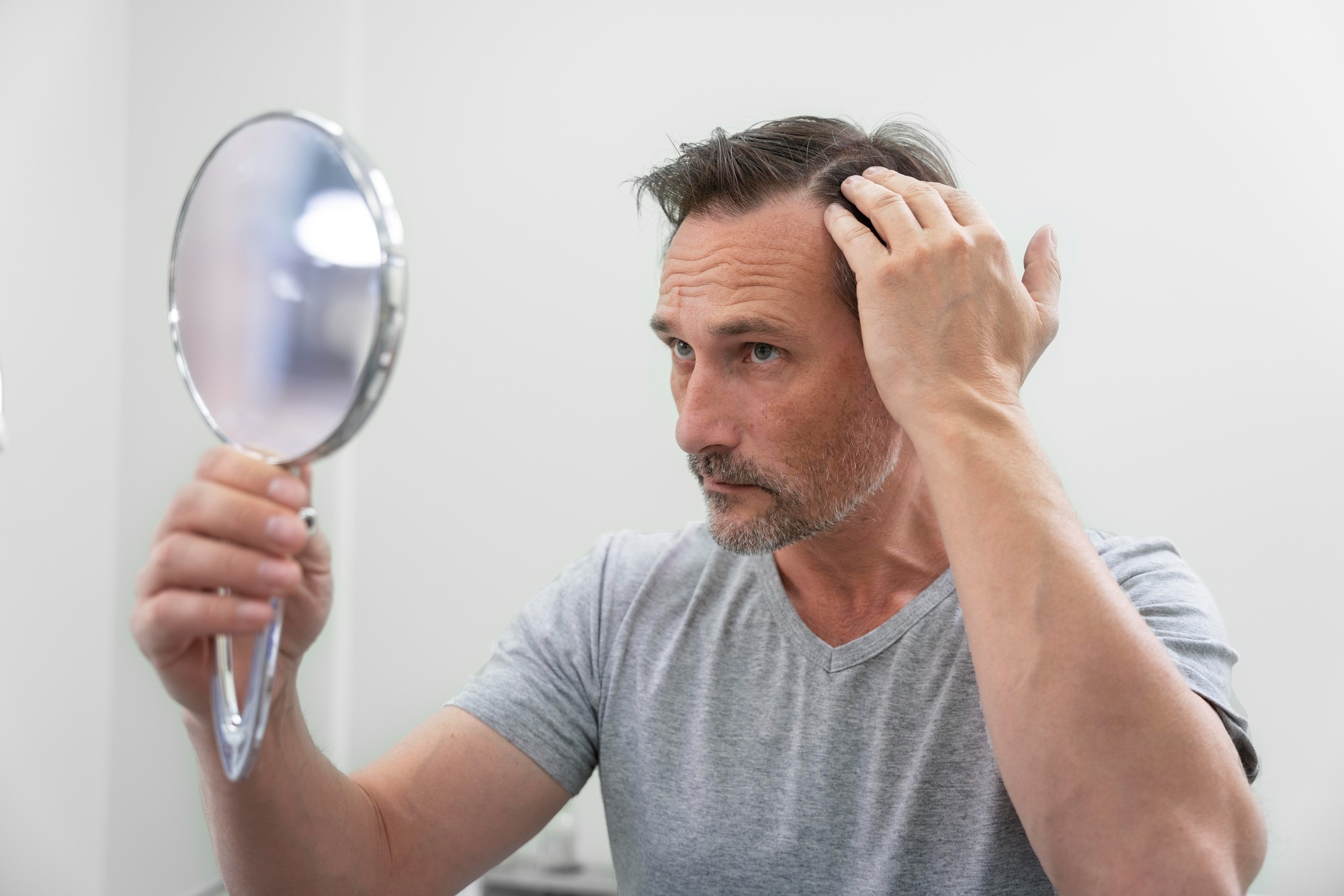 man-getting-hair-loss-treatment (2)